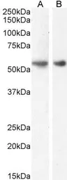 Anti-GLP1R antibody used in Western Blot (WB). GTX17606