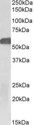 Anti-GLP1R antibody used in Western Blot (WB). GTX17606