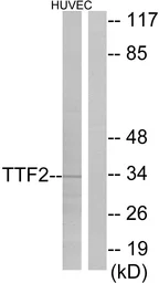 Anti-FOXE1 antibody used in Western Blot (WB). GTX17612