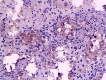 Anti-IL6 antibody used in IHC (Paraffin sections) (IHC-P). GTX17623