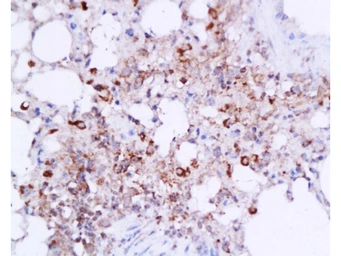Anti-IL6 antibody used in IHC (Paraffin sections) (IHC-P). GTX17623