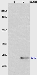 Anti-IL6 antibody used in Western Blot (WB). GTX17623