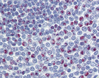 Anti-FOXM1 antibody used in IHC (Paraffin sections) (IHC-P). GTX17624