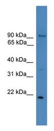 Anti-FOXM1 antibody used in Western Blot (WB). GTX17624