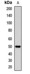 Anti-CD162 antibody used in Western Blot (WB). GTX17665