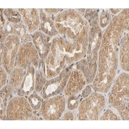 Anti-HSP27 (phospho Ser82) antibody used in IHC (Paraffin sections) (IHC-P). GTX17677