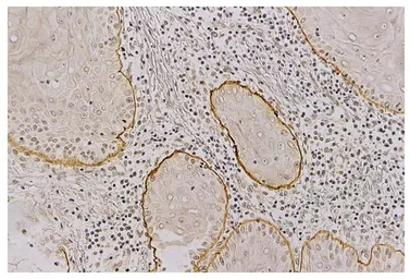 Anti-Laminin alpha 3A antibody [BG5] used in IHC (Paraffin sections) (IHC-P). GTX17685