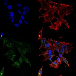 Anti-Protocadherin gamma (pan) antibody [S159-5] used in Immunocytochemistry/ Immunofluorescence (ICC/IF). GTX17690
