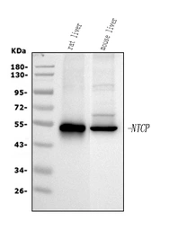 Anti-NTCP antibody used in Western Blot (WB). GTX17693