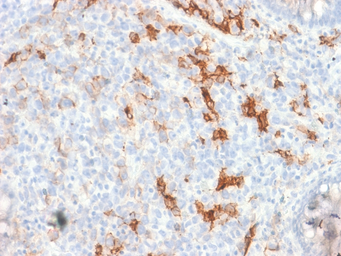 Anti-p75 NGF Receptor / CD271 antibody [NGFR/1997R] used in IHC (Paraffin sections) (IHC-P). GTX17697