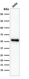 Anti-p53 antibody [TP53/2092R] used in Western Blot (WB). GTX17698