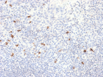 Rabbit Anti-Human IgG4 antibody [IGHG4/2042R]. GTX17708