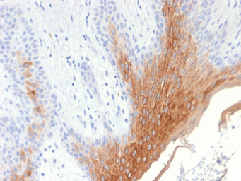 Anti-Cytokeratin 10 antibody [KRT10/1990R] used in IHC (Paraffin sections) (IHC-P). GTX17711