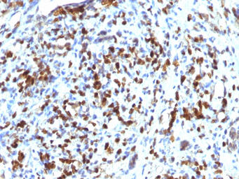 Anti-MyoD1 antibody [MYOD1/2075R] used in IHC (Paraffin sections) (IHC-P). GTX17712