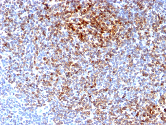 Anti-Bcl-2 antibody [BCL2/2210R] used in IHC (Paraffin sections) (IHC-P). GTX17713