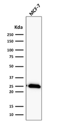 Anti-Bcl-2 antibody [BCL2/2210R] used in Western Blot (WB). GTX17713