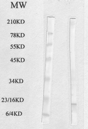 Anti-FABP4 antibody used in Western Blot (WB). GTX17718