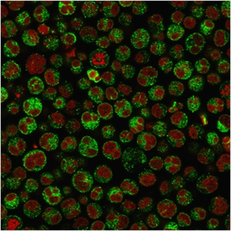 Anti-CD79a antibody [IGA/1790R] used in Immunocytochemistry/ Immunofluorescence (ICC/IF). GTX17720