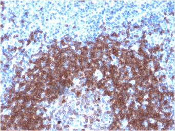 Anti-CD79a antibody [IGA/1790R] used in IHC (Paraffin sections) (IHC-P). GTX17720