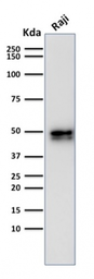 Anti-CD79a antibody [IGA/1790R] used in Western Blot (WB). GTX17720