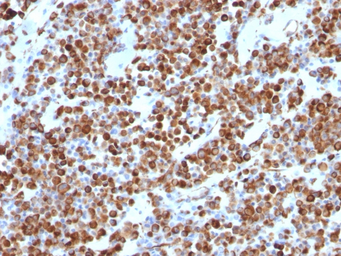 Anti-Vimentin antibody [VM452] used in IHC (Paraffin sections) (IHC-P). GTX17723