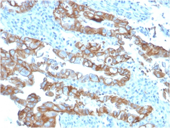 Anti-TACSTD2 antibody [TACSTD2/2153] used in IHC (Paraffin sections) (IHC-P). GTX17726