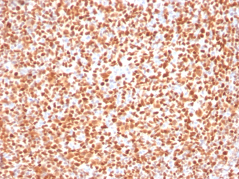 Anti-OCT2 antibody [OCT2/2137] used in IHC (Paraffin sections) (IHC-P). GTX17727