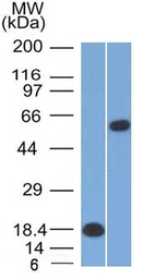 Anti-OCT2 antibody [OCT2/2137] used in Western Blot (WB). GTX17727