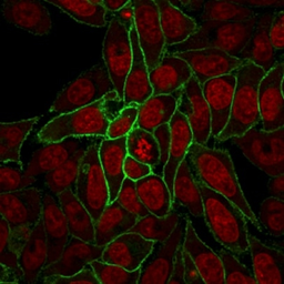 Anti-beta Catenin antibody [rCTNNB1/2173] used in Immunocytochemistry/ Immunofluorescence (ICC/IF). GTX17731