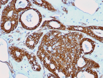Anti-beta Catenin antibody [rCTNNB1/2173] used in IHC (Paraffin sections) (IHC-P). GTX17731