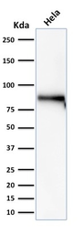 Anti-beta Catenin antibody [rCTNNB1/2173] used in Western Blot (WB). GTX17731