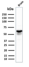 Anti-GAD67 antibody [GAD1/2391] used in Western Blot (WB). GTX17736
