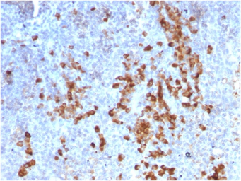 Mouse Anti-Human kappa light chain antibody [rKLC709]. GTX17737
