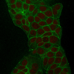 Anti-TACSTD2 antibody [TACSTD2/2152] used in Immunocytochemistry/ Immunofluorescence (ICC/IF). GTX17741