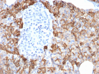 Anti-TACSTD2 antibody [TACSTD2/2152] used in IHC (Paraffin sections) (IHC-P). GTX17741
