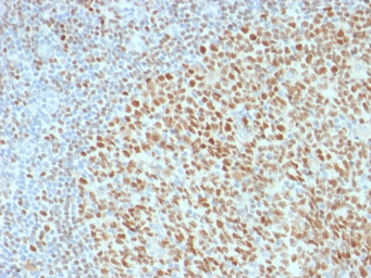 Anti-OCT2 antibody [OCT2/2136] used in IHC (Paraffin sections) (IHC-P). GTX17760