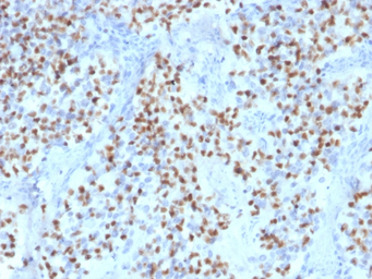 Anti-OCT2 antibody [OCT2/2136] used in IHC (Paraffin sections) (IHC-P). GTX17760
