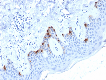 Anti-Melanoma gp100 antibody [PMEL/2038] used in IHC (Paraffin sections) (IHC-P). GTX17773