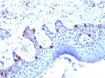 Anti-Melanoma gp100 antibody [PMEL/2039] used in IHC (Paraffin sections) (IHC-P). GTX17783