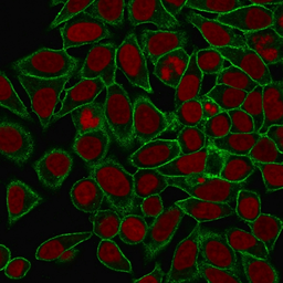 Anti-SPTBN2 antibody [SPTBN2/1778] used in Immunocytochemistry/ Immunofluorescence (ICC/IF). GTX17813
