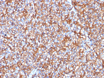 Anti-SPTBN2 antibody [SPTBN2/1778] used in IHC (Paraffin sections) (IHC-P). GTX17813