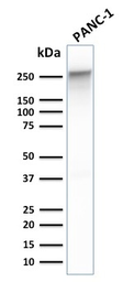 Anti-SPTBN2 antibody [SPTBN2/1778] used in Western Blot (WB). GTX17813