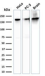 Anti-SPTBN2 antibody [SPTBN2/1778] used in Western Blot (WB). GTX17813