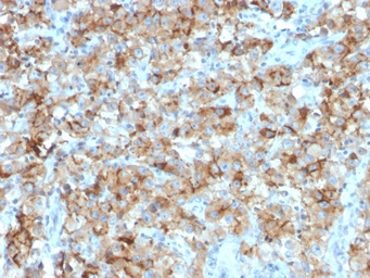 Anti-StAR antibody [STAR/2154] used in IHC (Paraffin sections) (IHC-P). GTX17814
