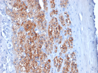 Anti-StAR antibody [STAR/2154] used in IHC (Paraffin sections) (IHC-P). GTX17814