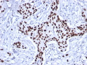 Anti-p53 antibody [rTP53/1739] used in IHC (Paraffin sections) (IHC-P). GTX17818