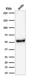 Anti-p53 antibody [rTP53/1739] used in Western Blot (WB). GTX17818