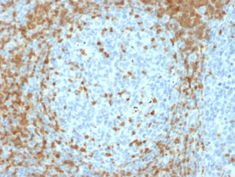 Anti-ZAP70 antibody [ZAP70/2035] used in IHC (Paraffin sections) (IHC-P). GTX17837