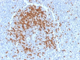 Anti-TCL1A antibody [TCL1/2078] used in IHC (Paraffin sections) (IHC-P). GTX17841