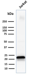 Anti-CD3 epsilon antibody [C3e/1931] used in Western Blot (WB). GTX17861